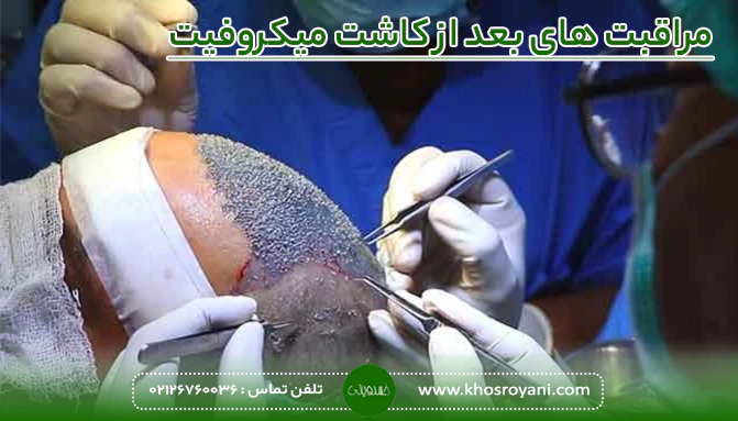مراقبت های بعد از کاشت میکروفیت