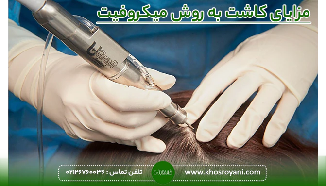 مزایای کاشت به روش میکروفیت