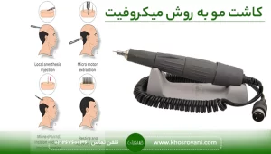 کاشت مو میکروفیت
