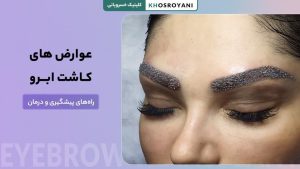 عوارض کاشت ابرو