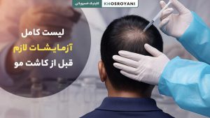 0 تا 100 آزمایشات کاشت مو