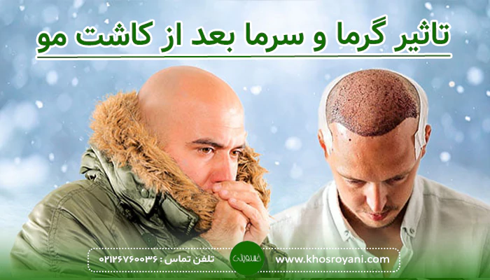تاثیر گرما و سرما بعد از کاشت مو