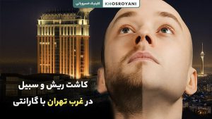 کاشت ریش و سبیل در غرب تهران با گارانتی