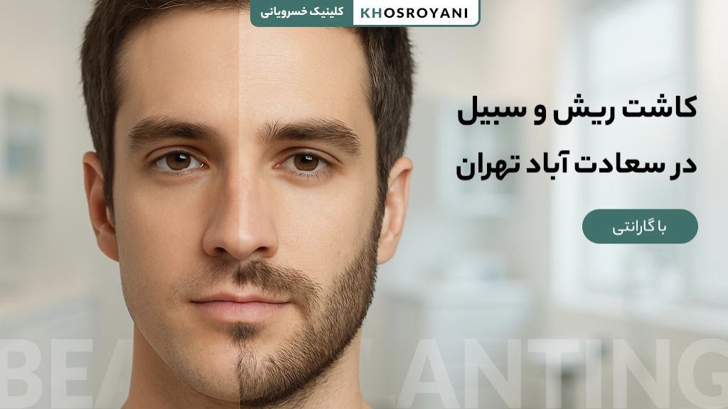 کاشت ریش و سبیل در سعادت آباد تهران