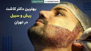 بهترین دکتر کاشت ریش و سبیل در تهران
