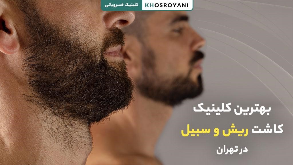 بهترین کلینیک کاشت ریش در تهران