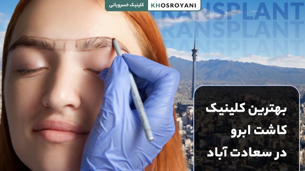 بهترین کلینیک کاشت ابرو در سعادت آباد