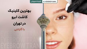 بهترین کلینیک کاشت ابرو در تهران