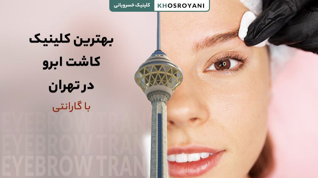 بهترین کلینیک کاشت ابرو در تهران