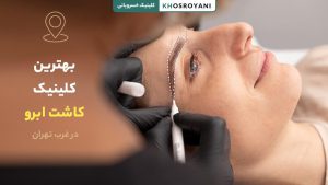 بهترین کلینیک کاشت ابرو در غرب تهران