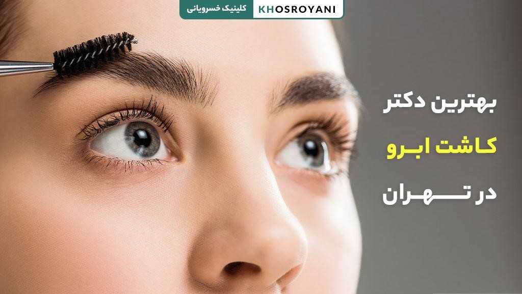 بهترین دکتر کاشت ابرو در تهران