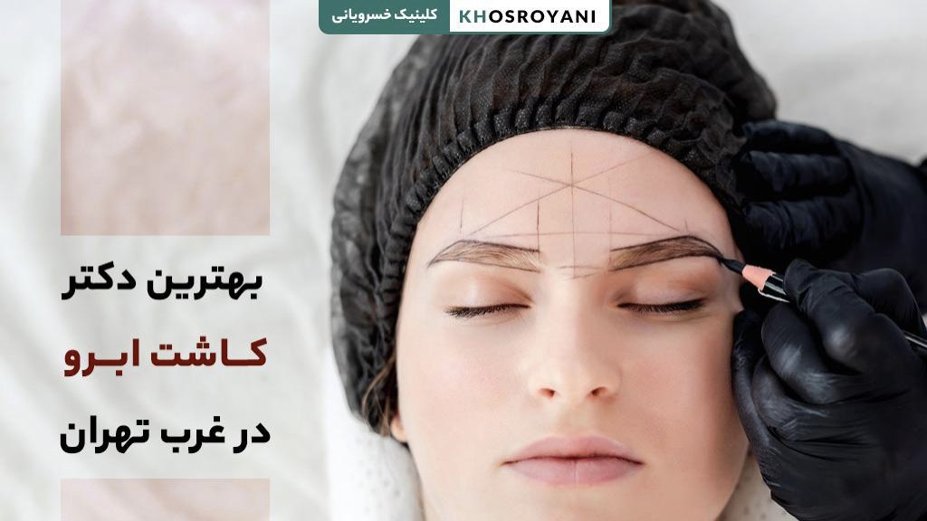 بهترین دکتر کاشت ابرو در غرب تهران