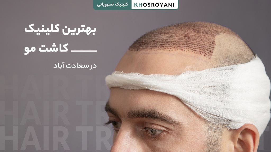 بهترین کلینیک کاشت مو در سعادت آباد