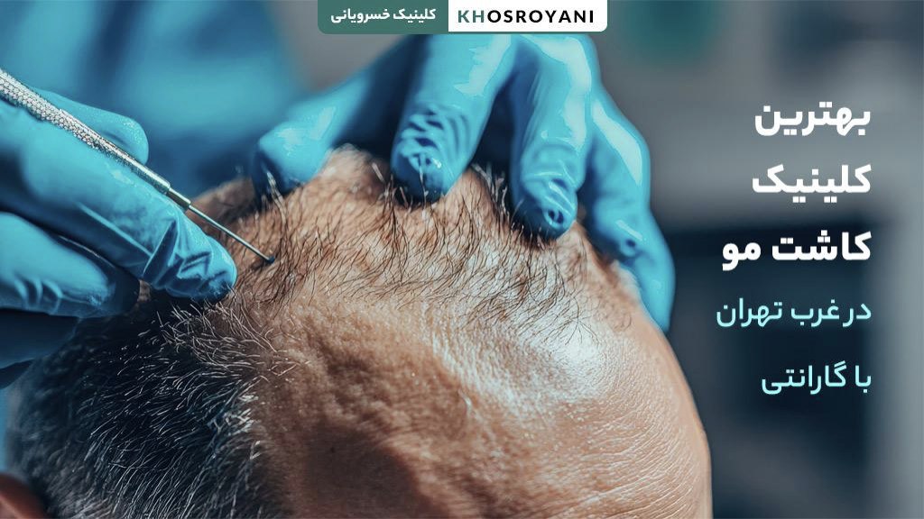 بهترین کلینیک کاشت مو در غرب تهران