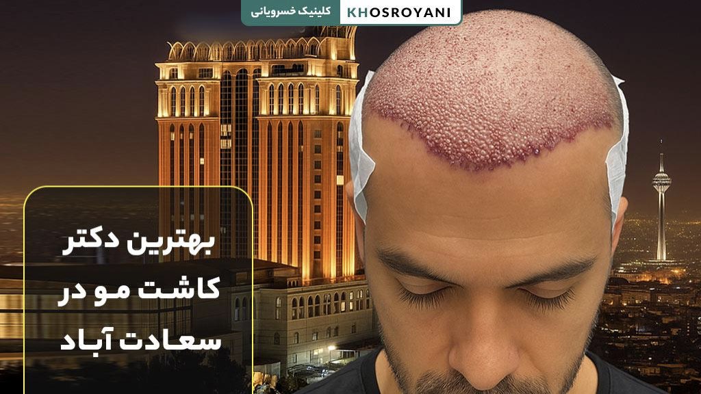 بهترین دکتر کاشت مو در سعادت آباد