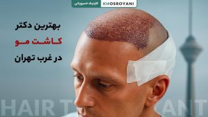 بهترین دکتر کاشت مو در غرب تهران