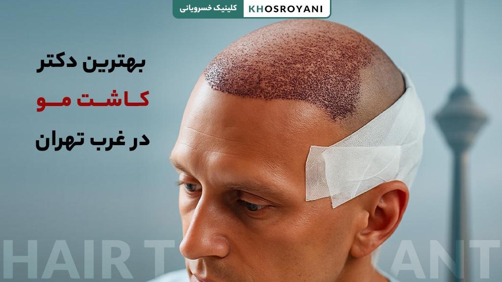 بهترین دکتر کاشت مو در غرب تهران