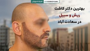 بهترین دکتر کاشت ریش در سعادت آباد