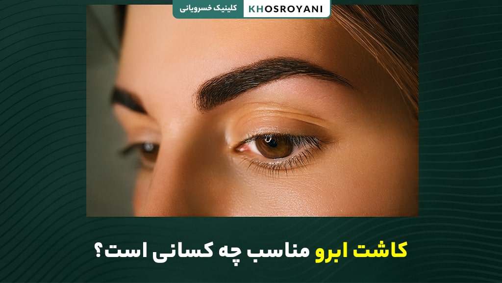 کاشت ابرو مناسب چه کسانی است؟